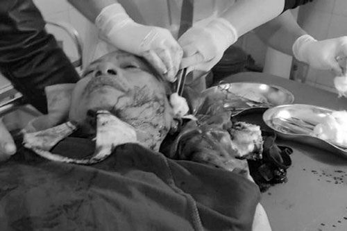 Công an viên xã  bị vây chém trọng thương trong đêm