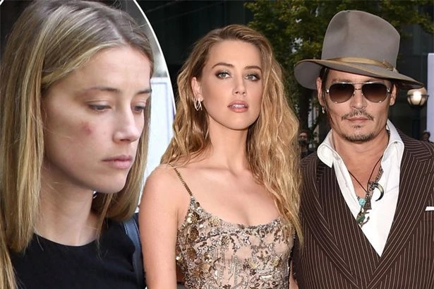 Hóa ra Johnny Depp bị vợ cũ đánh đập - Ảnh 1.