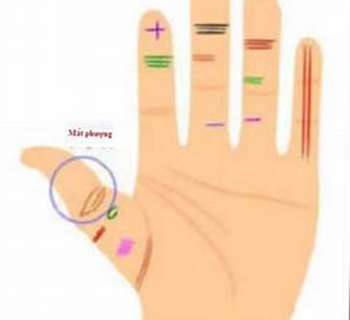 Thứ trên ngón tay cái rất ít người có, mà một khi đã có tất hậu vận giàu sang, tiền tài rủng rỉnh