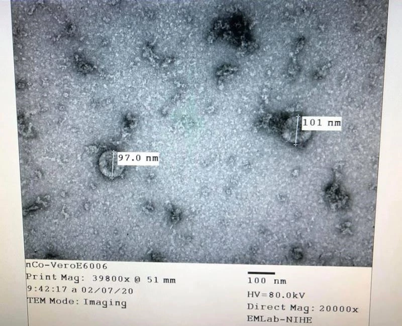 Việt Nam đã nuôi cấy và phân lập thành công virus corona (nCoV).