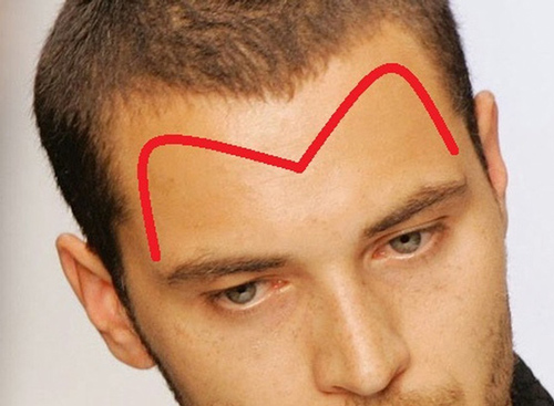 Đàn ông sở hữu 4 tướng trán này sau tuổi 30 cuộc sống giàu sang viên mãn không ai sánh bằng