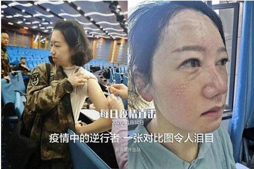 Liu Li, nhân viên y tế của Đại học Quân y và là y tá trưởng Khoa Phẫu thuật Gan mật của Bệnh viện Tây Nam phải chia tay con gái vào đêm Giao thừa tại sân bay để đến với những bệnh nhân tại Vũ Hán, Trung Quốc. Trước khi khởi hành, bệnh viện đã sắp xếp tiêm cho mỗi nhân viên một mũi thymosin để cải thiện khả năng miễn dịch. Bức ảnh bên phải được chụp những ngày gần đây, Liu Li không cầm được nước mắt khi phỏng vấn. (Ảnh: Nhân Dân nhật báo)