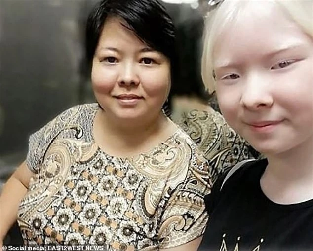 Diện mạo khác lạ của hai chị em người Kazakhstan bị bạch tạng gây 'sốt' - ảnh 8
