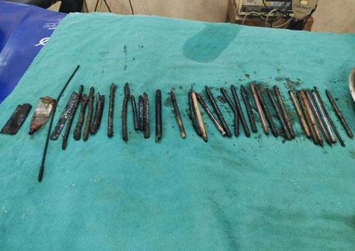 Kỳ lạ người đàn ông thích nuốt lưỡi lam, tua vít