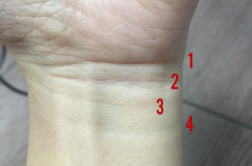 Có 5 dấu hiệu này trên cổ tay sớm muộn gì cũng giàu 'nứt đố đổ vách', đếm tiền mệt nghỉ