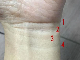 Có 5 dấu hiệu này trên cổ tay sớm muộn gì cũng giàu 'nứt đố đổ vách', đếm tiền mệt nghỉ