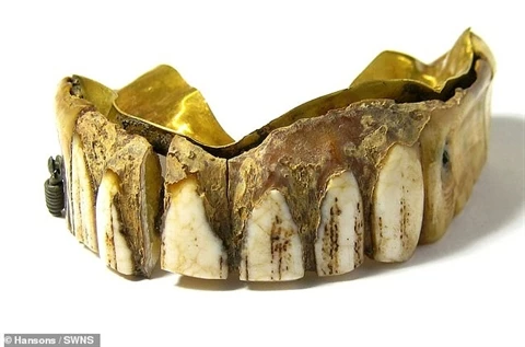 Hàm răng được tìm thấy ở một cánh đồng khi dò kho báu
