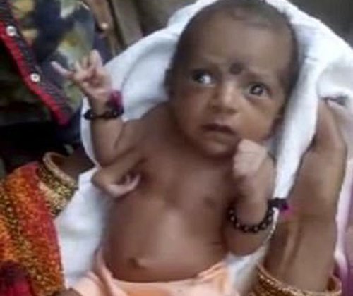 Bé gái 3 cánh tay được tôn thờ như vị thần ở Ấn Độ