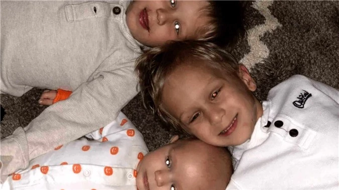Bức ảnh chụp 3 cậu bé có chung một đặc điểm nhưng đó lại là dấu hiệu ung thư - 1