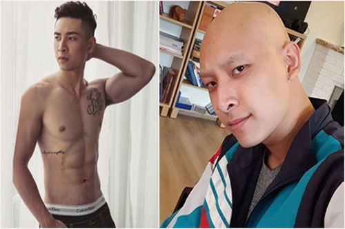 Người mẫu Vietnam's Next Top phải cạo trọc đầu vì bệnh nan y