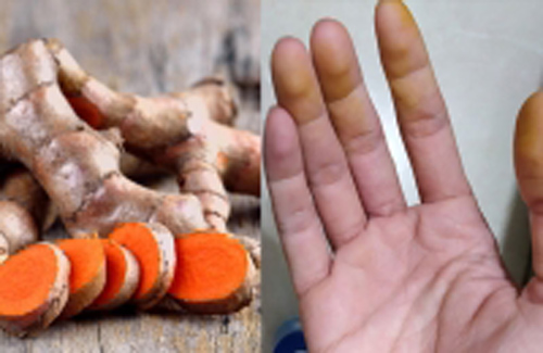 Tay vàng khè vì nghệ cỡ nào cũng trắng tinh nếu chị em làm theo cách này