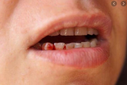 Thấy dấu hiệu này hãy tới bác sĩ khám ngay kẻo cứu không kịp