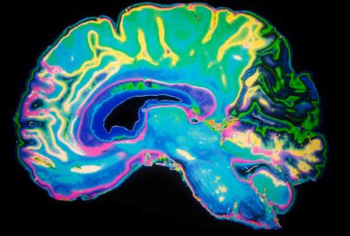 Kết quả nghiên cứu mới về cấu trúc não bộ của người phạm tội nhiều lần