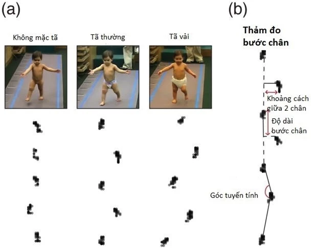 Việc mặc tã cũng ảnh hưởng đến dáng đi của trẻ.