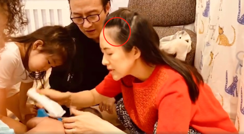 Sau khi sinh con, Chương Tử Di xuống sắc thấy rõ, tóc rụng đáng báo động đến mức lộ cả mảng hói