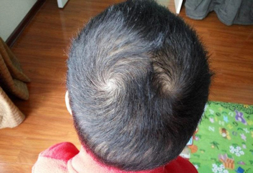 Đàn ông sở hữu nét quý tướng sau trung vận sẽ chuyển mình giàu có, nhưng lại mắc tật trăng hoa đa tình