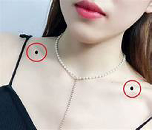 3 vị trí nốt ruồi xui xẻo cần phải xóa ngay nếu không muốn cả đời nghèo khổ, tai họa triền miên