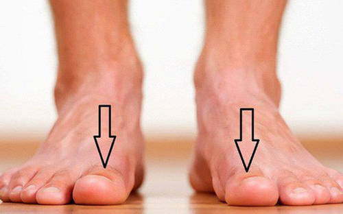 Dấu hiệu "lạ" ở bàn chân cảnh báo gan đang gặp nguy hiểm từng ngày, nhiều người mắc phải mà không biết