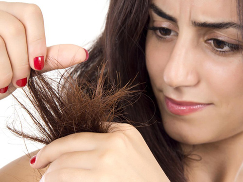 Thói quen tai hại khiến rụng tóc- hói đầu, đa số người Việt vẫn làm hằng ngày