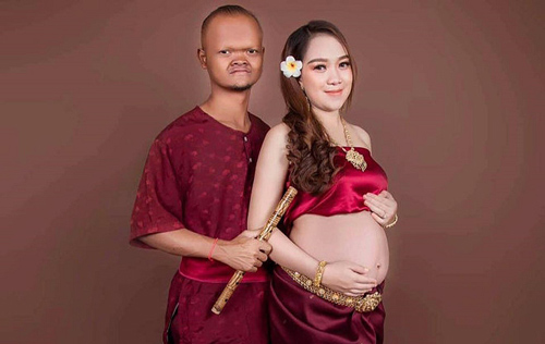 Cặp "chồng cú vợ tiên" sinh con đầu lòng nhưng nhan sắc của đứa trẻ mới gây chú ý