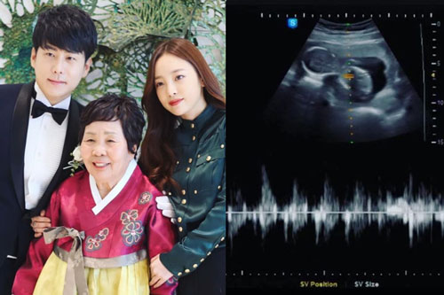 Đúng kỷ niệm ngày cưới, anh trai nghẹn ngào tưởng nhớ Goo Hara: "Anh hy vọng em sẽ tái sinh và trở thành con gái anh"