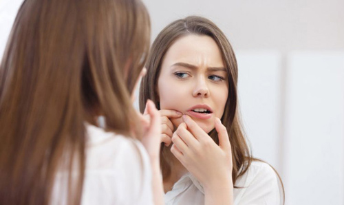 Vùng "tam giác tử thần" trên mặt, tuyệt đối không được nặn mụn