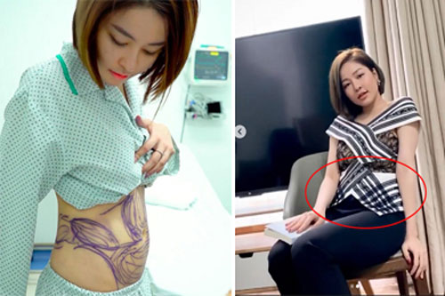 Hot girl Trâm Anh lộ vòng eo bánh mì dù tốn hàng trăm triệu hút mỡ bụng