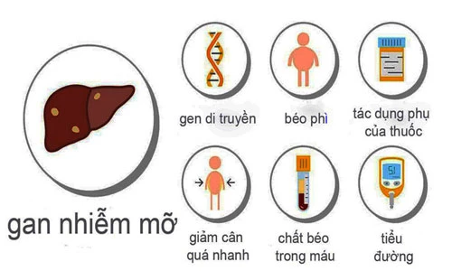 Các nguyên nhân của gan nhiễm mỡ