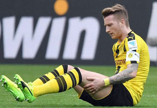 Dortmund "mất" Marco Reus ở trận tái đấu PSG