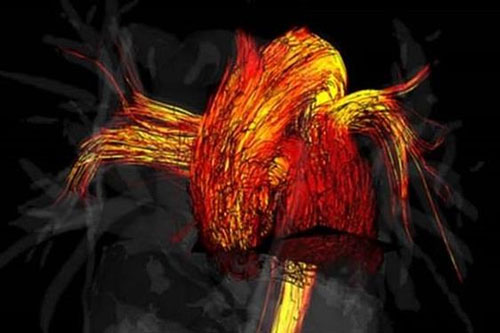 Khoa học chứng minh tim đàn ông hoạt động 'chăm chỉ' hơn tim phụ nữ