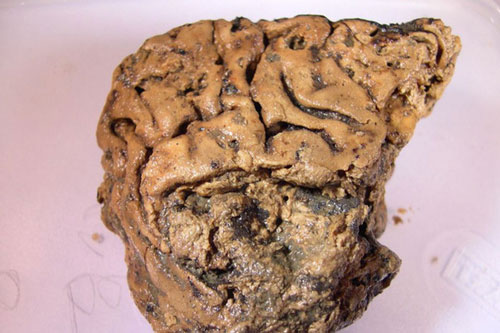 Bí ẩn về mảnh não 2.700 năm tuổi vẫn nguyên vẹn dù cho không hề được tẩm ướp