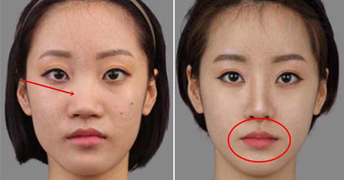 4 bộ phận nghiêm cấm chỉnh sửa kẻo hỏng tướng, thay đổi luôn vận đào hoa may mắn của con người