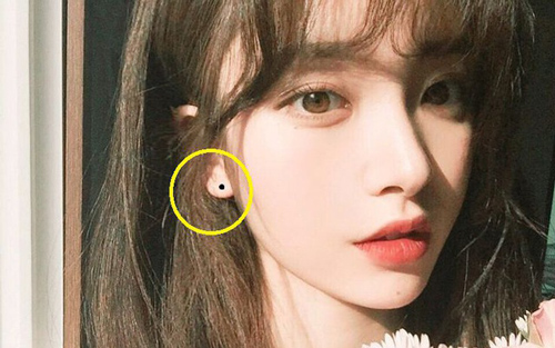 Có nốt ruồi ở 5 chỗ này là "hố vàng hút lộc", tài lộc suốt đời, tử vi lúc nào cũng đỏ chót