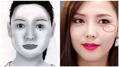 7 nốt ruồi "độc" mang đến toàn vận xui, giữ lại thì cả đời nghèo hèn, xoá bỏ sạch mới mong đổi vận