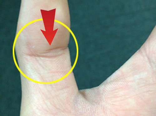 Những điểm cực hiếm trên bàn tay là "thần Tài hộ mệnh", mang vô số "lộc lá" đến cho người sở hữu