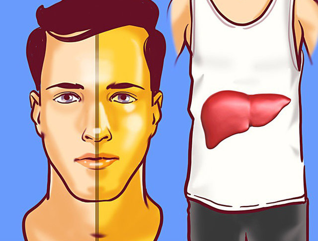 Thấy cơ thể có những dấu hiệu này, hãy cảnh giác vì ung thư gan có thể "gõ cửa", chớ dại coi thường