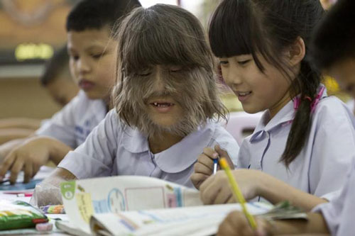 Top 10 người ‘quái dị’ nhất thế giới: Việt Nam cũng có một cái tên, đó là ai?