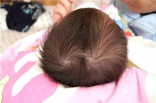 Khỏi cần đi xem bói, nhìn xoáy tóc trên đầu biết ngay số phận con người