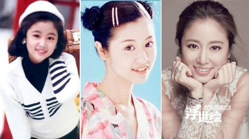 Loạt sao Hoa ngữ 'đổi đời' chỉ nhờ chỉnh răng