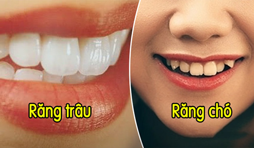 Coi tướng răng biết ngay vận mệnh sang - hèn, là đại gia hay nghèo mạt vận