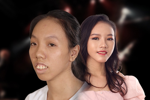 Cùng chung số phận bị chồng hắt hủi vì quá xấu, 2 "Thị Nở" thời hiện đại lột xác bất ngờ nhờ phẫu thuật thẩm mỹ