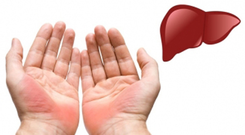 Xòe lòng bàn tay và nắm chặt, nếu thấy có dấu hiệu này hãy đi khám càng nhanh càng tốt