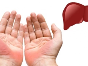 Xòe lòng bàn tay và nắm chặt, nếu thấy có dấu hiệu này hãy đi khám càng nhanh càng tốt