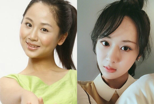 Điểm danh những tiểu hoa đán 9X 'vô tình' để lộ dấu vết phẫu thuật thẩm mỹ