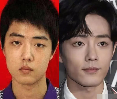 Đâu chỉ có sao nữ, loạt nam thần Hoa ngữ cũng vướng nghi vấn phẫu thuật thẩm mỹ để nâng tầm nhan sắc