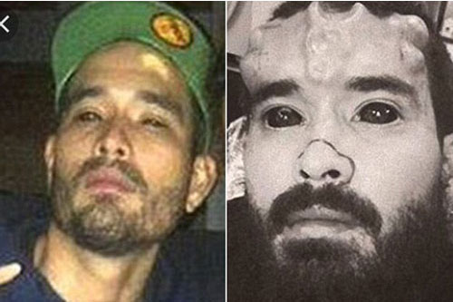 Chi 800 triệu phẫu thuật mặt giống... ác quỷ, bố nhận phản ứng bất ngờ từ con trai