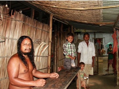 Khỏa thân suốt 40 năm do dị ứng quần áo