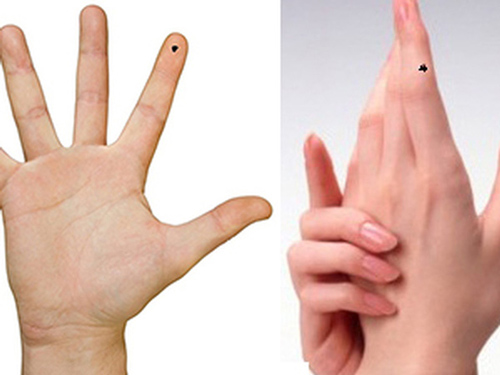 Bàn tay sở hữu nốt ruồi ở vị trí này, chắc chắn bạn sinh ra là người giàu sang, phú quý
