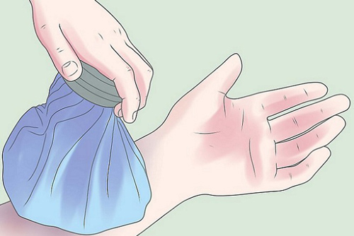 Con nghịch dại dẫn đến chân tay tím tái: Mẹ chỉ cần dùng 3 mẹo nhỏ sau, sẽ nhanh chóng đánh tan máu bầm