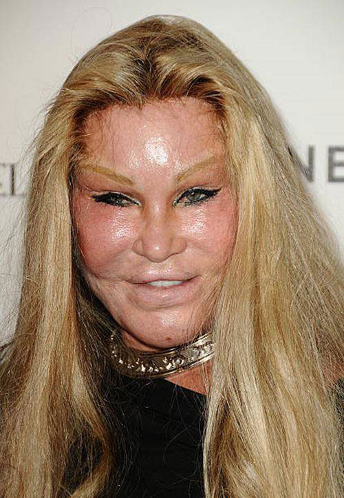 Jocelyn Wildenstein sau khi chi hàng chục tỷ đồng vào phẫu thuật thẩm mỹ gây "chấn động" thế giới vì gương mặt méo mó, cặp mắt xếch như những chú mèo. Jocelyn Wildenstein sau khi chi hàng chục tỷ đồng vào phẫu thuật thẩm mỹ gây "chấn động" thế giới vì gương mặt méo mó, cặp mắt xếch như những chú mèo.